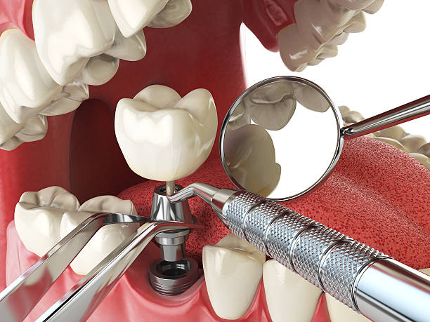 Best Pediatric Emergency Dentist in La Cygne, KS